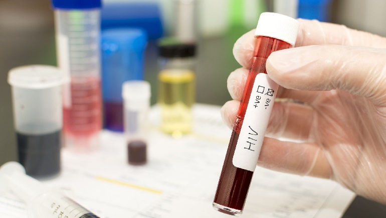 Patient Cured of HIV after Stem Cell Transplant, Say Researchers