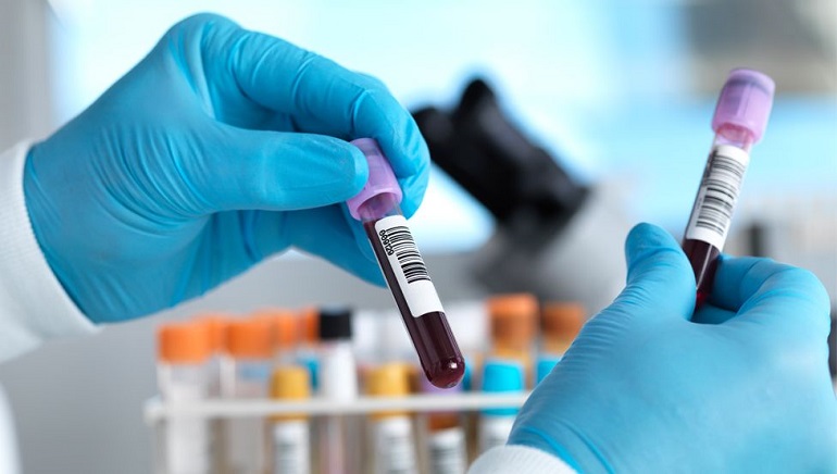 UK To Expand Multi-Cancer Blood Test to One Million Patients
