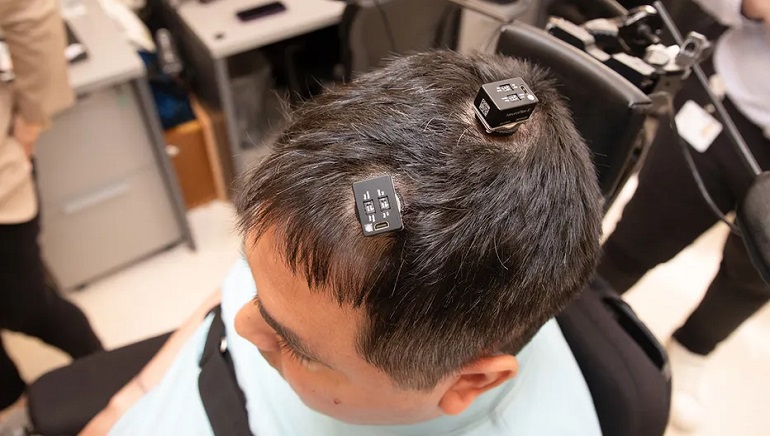 AI Brain Implant Helps Paralysed Man Move, Feel Again
