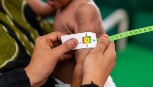 UAE and WHO Collaborate to Tackle Child Mortality in Yemen