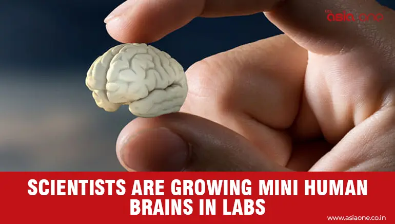 Scientists Are Growing Mini Human Brains in Labs