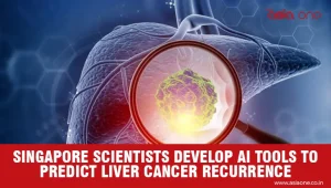 Singapore AI Breakthrough Improves Liver Cancer Recurrence Prediction
